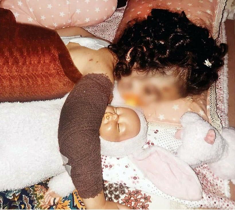 حمله خونین سگ‌های ولگرد به دختر سه‌ساله و مادرش در کرج

